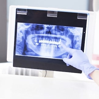 Dentistry in Seattle provides digital x-rays for all